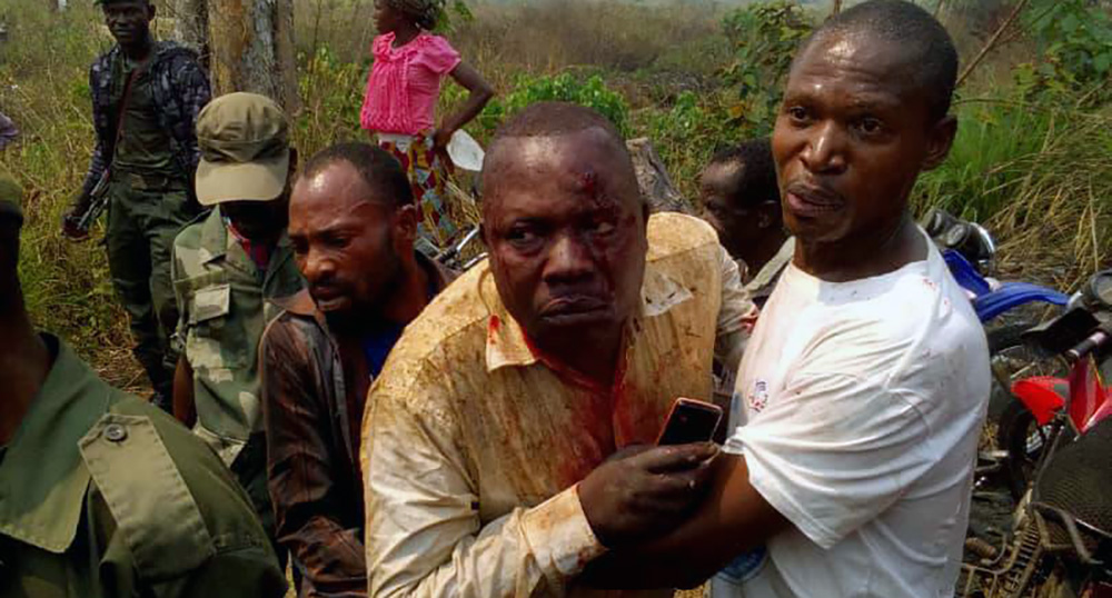 Adventist lay evangelist Pius Kabadi Tshiombe, 53, center, being helped from the site of an An-2 plane crash about 2 miles (3 kilometers) from Kamako airport in the Democratic Republic of Congo on July 27, 2018. (Nicole Ntumba Kabadi / For Adventist Mission)